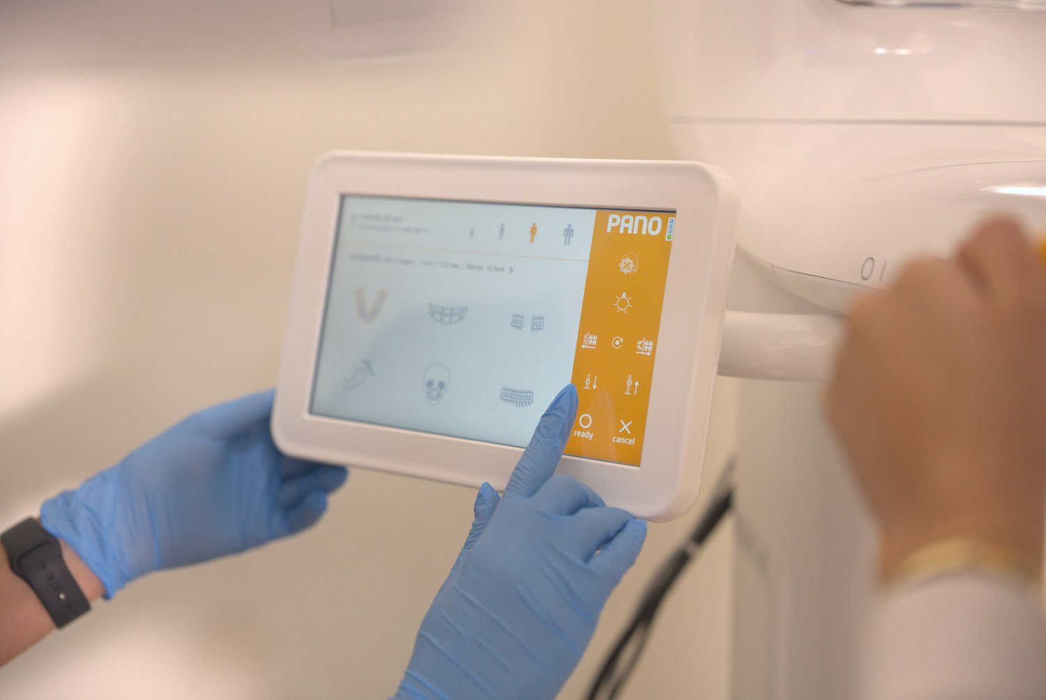 iTero scanner screen used for digital dental impressions at 313 Dental